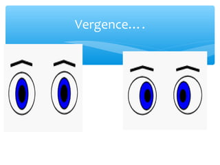 Vergence….
 