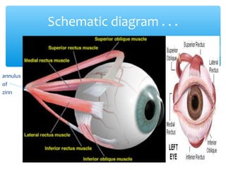 annulus
of
zinn
Schematic diagram . . .
 
