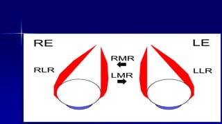 Optom. Ankit Varshney 17
 