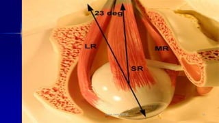 Optom. Ankit Varshney 19
 