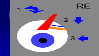 Optom. Ankit Varshney 27
 