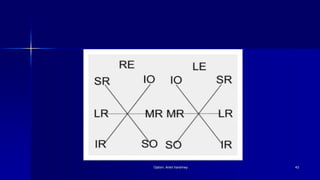 Optom. Ankit Varshney 43
 