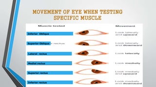 Superior Oblique
Inferior Oblique
Superior rectus
Inferior rectus
Medial rectus
Lateral rectus
MOVEMENT OF EYE WHEN TESTING
SPECIFIC MUSCLE
 