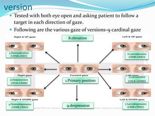 version
 Tested with both eye open and asking patient to follow a
target in each direction of gaze.
 Following are the various gaze of versions-9 cardinal gaze
3.Dextroelevation
(ODSR+OSIO)
2.Destroversion
ODLR+OSMR)
5.Laevoversion
(OSLR+ODMR)
6.Laevoelevation
(OSSR+ODIO)
7.Laevodrepression
(OSIR+ODSO)9.drepression
8.elevation
1.Primary position
4.Dextrodrepression
(ODIR+OSSO)
 
