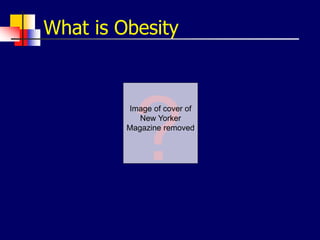 What is Obesity
Image of cover of
New Yorker
Magazine removed
 