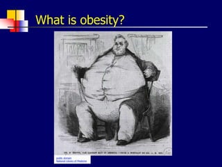 What is obesity?
public domain
National Library of Medicine
 