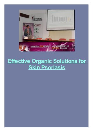 Effective Organic Solutions for
Skin Psoriasis
 
