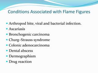 Conditions Associated with Flame Figures
 Arthropod bite, viral and bacterial infection.
 Ascariasis
 Bronchogenic carcinoma
 Churg–Strauss syndrome
 Colonic adenocarcinoma
 Dental abscess
 Dermographism
 Drug reaction
 