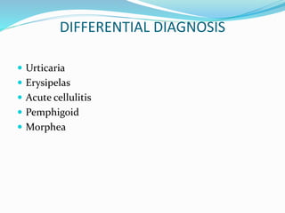 DIFFERENTIAL DIAGNOSIS
 Urticaria
 Erysipelas
 Acute cellulitis
 Pemphigoid
 Morphea
 