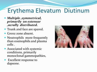 Erythema Elevatum Diutinum
 Multiple ,symmetrical,
primarily on extensor
,acrally distributed.
 Trunk and face are spared.
 Grenz zone absent.
 Neutrophils more frequently
than eosinophils and plasma
cells .
 Associated with systemic
conditions, primarily
monoclonal gammopathies,
 Excellent response to
dapsone.
 