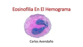 Eosinofilia En El Hemograma
Carlos Avendaño
 