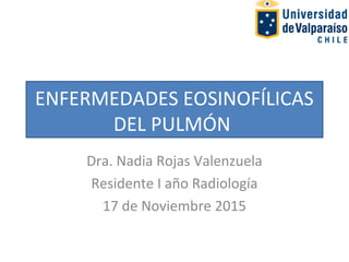 ENFERMEDADES EOSINOFÍLICAS
DEL PULMÓN
Dra. Nadia Rojas Valenzuela
Residente I año Radiología
17 de Noviembre 2015
 