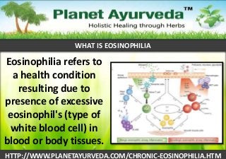WHAT IS EOSINOPHILIA

Eosinophilia refers to
a health condition
resulting due to
presence of excessive
eosinophil's (type of
white blood cell) in
blood or body tissues.
HTTP://WWW.PLANETAYURVEDA.COM/CHRONIC-EOSINOPHILIA.HTM

 