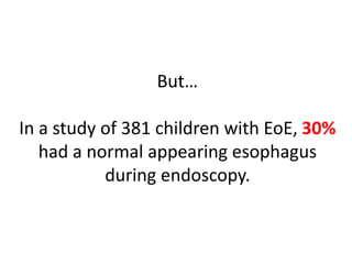 But…
In a study of 381 children with EoE, 30%
had a normal appearing esophagus
during endoscopy.
 