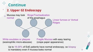 Tearing Ridges Eosinophilic esophegaitis Topic presentation.ppt