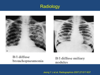 Radiology




 Jeong Y J et al. Radiographics 2007;27:617-637
 