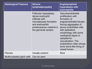 Histological Features Kimura
lymphadenopathy
Angiolymphoid
hyperplasia with
eosinophilia
Follicular hyperplasia,
dense eosinophil
infiltrate with
microabscess formation
and eosinophilic
proteinaceous material in
the germinal centers.
Vasculoendothelial
proliferation with
formation of
angioendothelial lobules
having aggregates of
plump endothelial cells
with epithelioid
morphology with some
cytological atypia or
cytoplasmic
vacuolization. The
endothelium often shows
tomb stone like lining of
vessel lumen.
Fibrosis Usually present Rare
Multinucleated giant cells Can be seen
Dr. Monika Nema
 