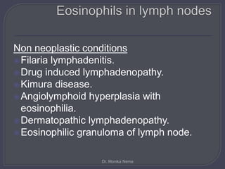 Non neoplastic conditions
Filaria lymphadenitis.
Drug induced lymphadenopathy.
Kimura disease.
Angiolymphoid hyperplasia with
eosinophilia.
Dermatopathic lymphadenopathy.
Eosinophilic granuloma of lymph node.
Dr. Monika Nema
 