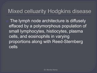  The lymph node architecture is diffusely
effaced by a polymorphous population of
small lymphocytes, histiocytes, plasma
cells, and eosinophils in varying
proportions along with Reed-Sternberg
cells
Dr. Monika Nema
 