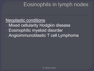 Neoplastic conditions
Mixed cellularity Hodgkin disease
Eosinophilic myeloid disorder
Angioimmunoblastic T cell Lymphoma
Dr. Monika Nema
 