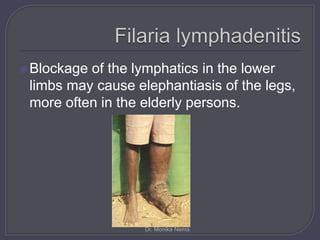 Blockage of the lymphatics in the lower
limbs may cause elephantiasis of the legs,
more often in the elderly persons.
Dr. Monika Nema
 