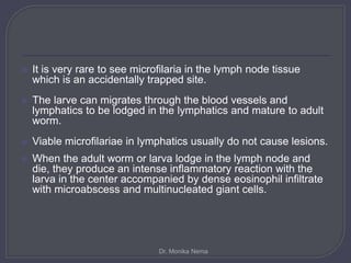  It is very rare to see microfilaria in the lymph node tissue
which is an accidentally trapped site.
 The larve can migrates through the blood vessels and
lymphatics to be lodged in the lymphatics and mature to adult
worm.
 Viable microfilariae in lymphatics usually do not cause lesions.
 When the adult worm or larva lodge in the lymph node and
die, they produce an intense inflammatory reaction with the
larva in the center accompanied by dense eosinophil infiltrate
with microabscess and multinucleated giant cells.
Dr. Monika Nema
 