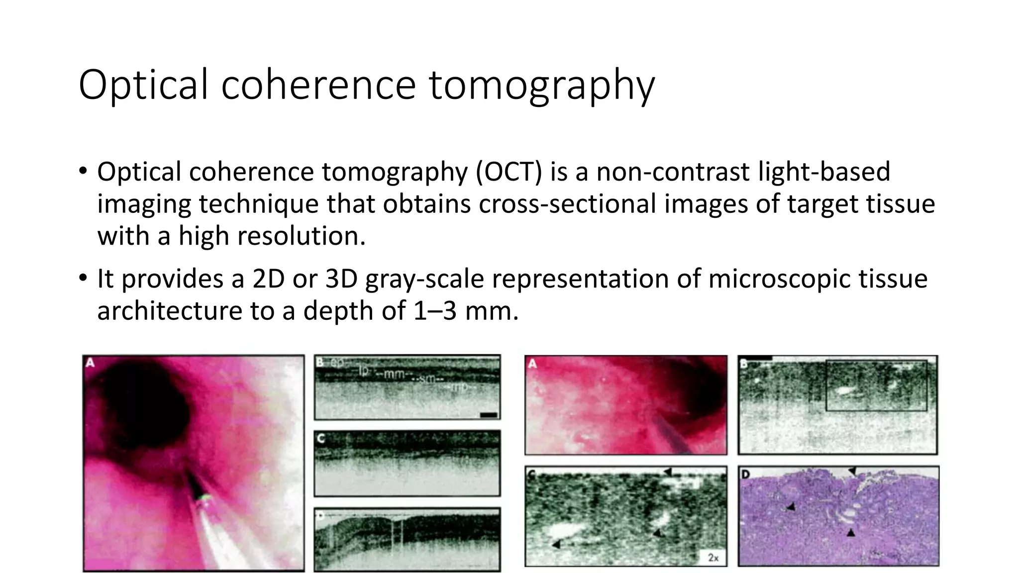 Optical coherence tomography
• Optical coherence tomography (OCT) is a non-contrast light-based
imaging technique that obtains cross-sectional images of target tissue
with a high resolution.
• It provides a 2D or 3D gray-scale representation of microscopic tissue
architecture to a depth of 1–3 mm.
 