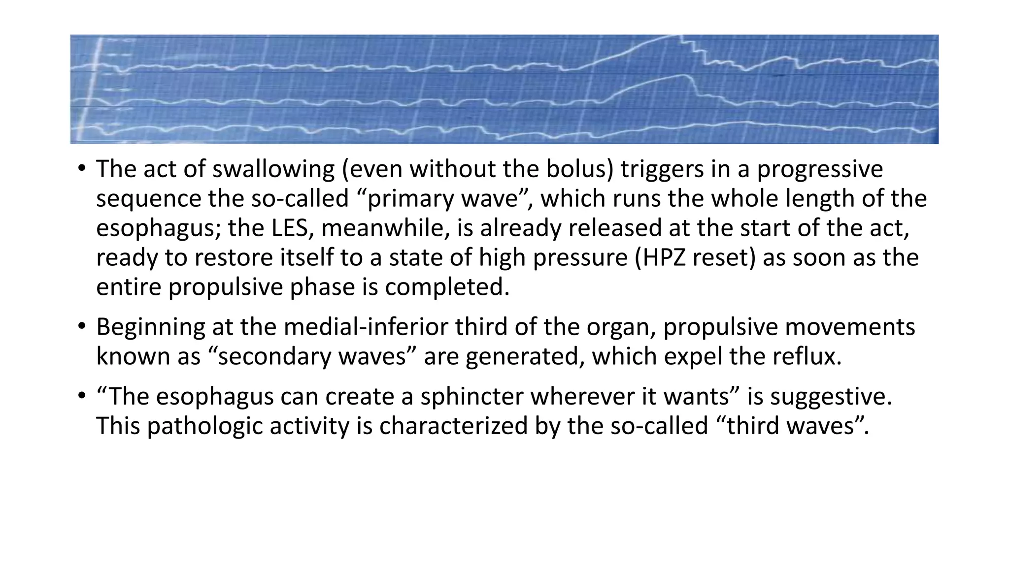 • The act of swallowing (even without the bolus) triggers in a progressive
sequence the so-called “primary wave”, which runs the whole length of the
esophagus; the LES, meanwhile, is already released at the start of the act,
ready to restore itself to a state of high pressure (HPZ reset) as soon as the
entire propulsive phase is completed.
• Beginning at the medial-inferior third of the organ, propulsive movements
known as “secondary waves” are generated, which expel the reflux.
• “The esophagus can create a sphincter wherever it wants” is suggestive.
This pathologic activity is characterized by the so-called “third waves”.
 