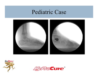 Pediatric Case
 