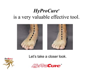 HyProCure®
is a very valuable effective tool.
Let’s take a closer look.
 