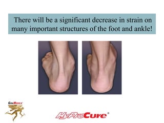 There will be a significant decrease in strain on
many important structures of the foot and ankle!
 