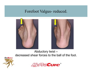 Forefoot Valgus- reduced.
Abductory twist –
decreased shear forces to the ball of the foot.
 
