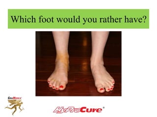 Which foot would you rather have?
 