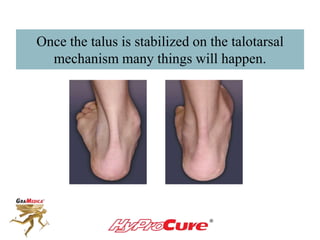 Once the talus is stabilized on the talotarsal
mechanism many things will happen.
 