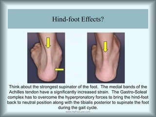Hind-foot Effects?Think about the strongest supinator of the foot.  The medial bands of the Achilles tendon have a significantly increased strain.  The Gastro-Soleal complex has to overcome the hyperpronatory forces to bring the hind-foot back to neutral position along with the tibialis posterior to supinate the foot during the gait cycle.www.HyProCure.com
