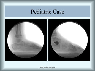 Anterior deviated Cyma