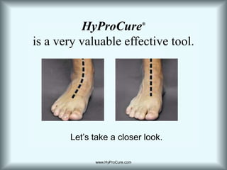 HyProCure®is a very valuable effective tool.Let’s take a closer look.www.HyProCure.com