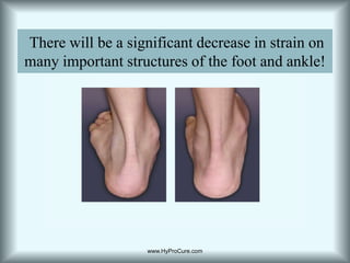  There will be a significant decrease in strain on many important structures of the foot and ankle!www.HyProCure.com