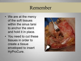 BAD SHOEGEAR is the #1 cause for post-op discomfort.ALWAYS CHECK THE SHOES YOUR PATIENTS ARE WEARING.