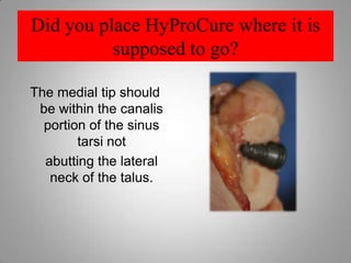 What makes a great versus a good surgeon is how that complication is handled.