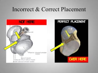 Inability to achieve the desired outcome