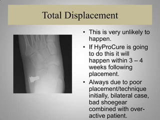 Good TechniqueUse sharp curved Stevens Tenotomy scissors with the scissors pointed posteriorly.