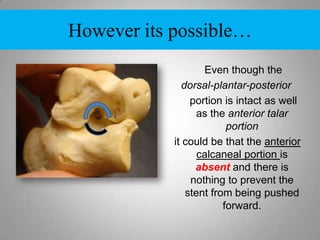 Just as long as the correction is maintained and it doesn’t laterally displace anymore it will work.  However-----If this is the AP fluoro you just took after inserting HyProCure and it looks like this               do not be satisfied.  It is possible you only cut ½ of the fibers within the canalis and they are blocking final position of  the device.What to doUse a needle driver and pull HyProCure out.