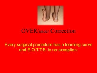 Get the curved Stevens Tenotomy scissors (make sure they are sharp, if unsure call for another pair) and make sure you have cut the fibers deep within the canalis