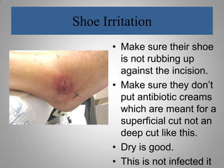 After sitting, get up to walk, ankle is stiff