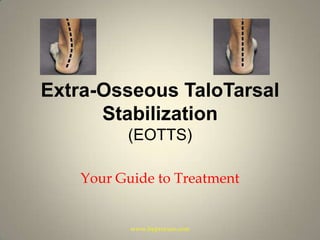 Extra-Osseous TaloTarsal Stabilization
(EOTTS)
Your Guide to Treatment
 