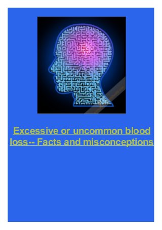Excessive or uncommon blood
loss-- Facts and misconceptions

 