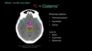 Ep. 1 Head CT Scan - dr. Hana Larassati.pdf