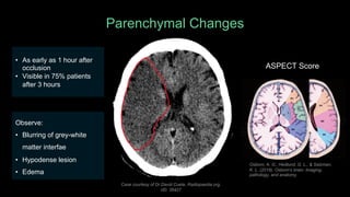 Ep. 1 Head CT Scan - dr. Hana Larassati.pdf
