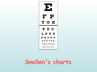 Snellen's charts
 